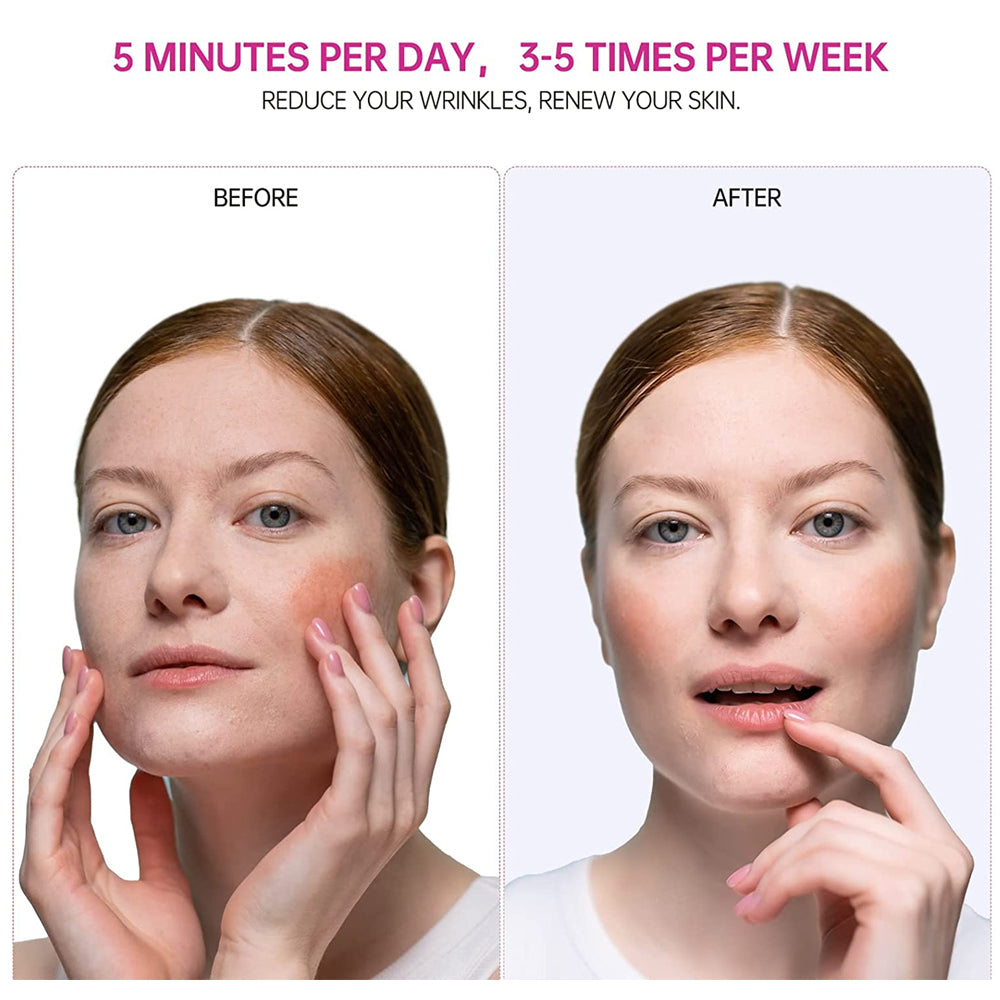 Before and after skincare routine comparison image for facial massage device results